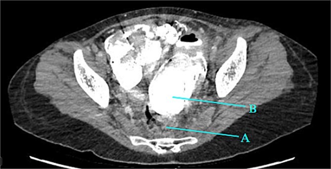 Figure 5