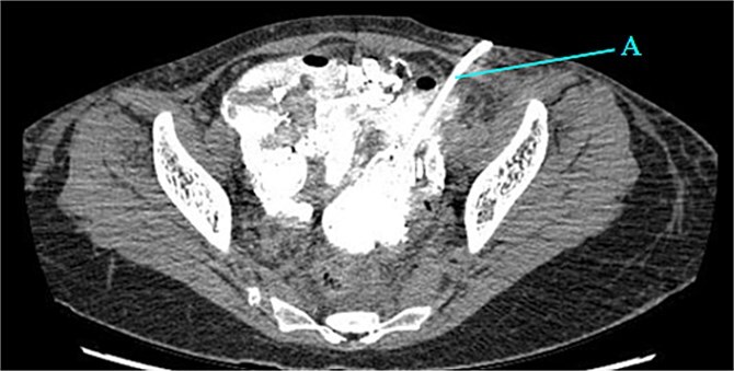 Figure 6