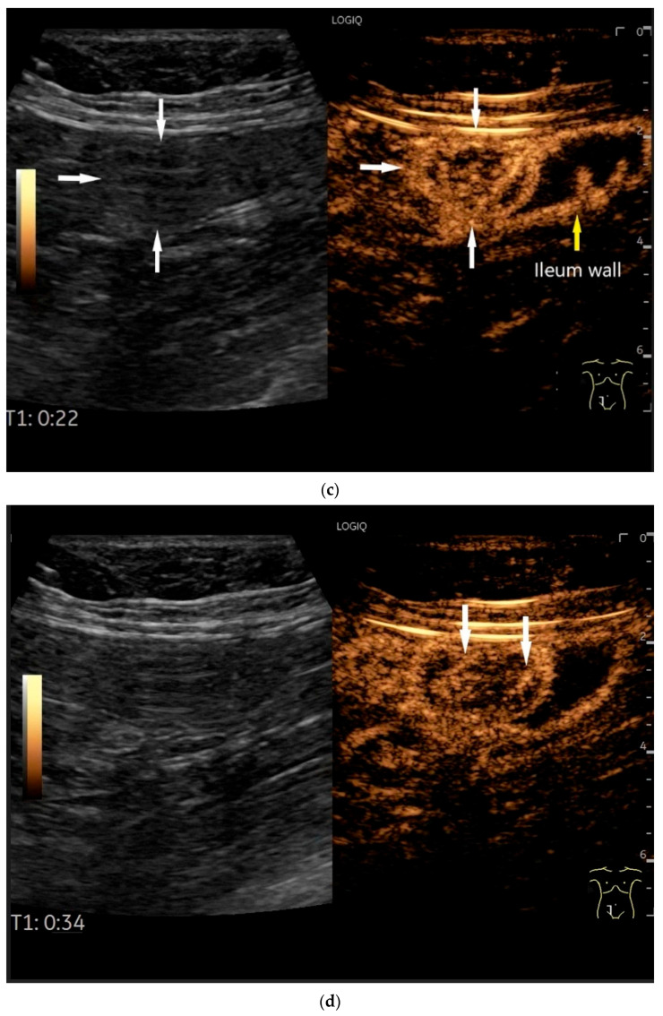 Figure 9