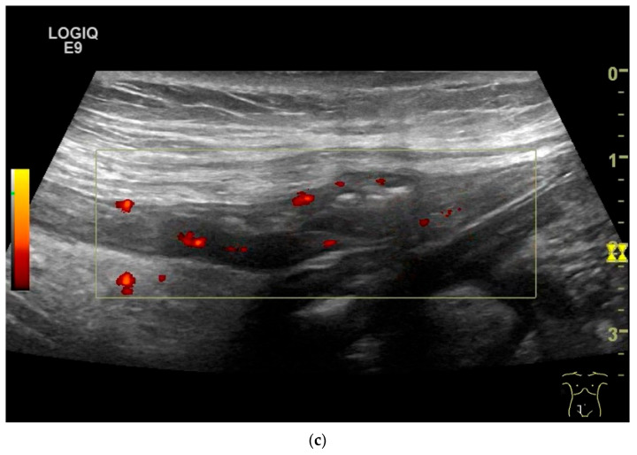 Figure 11