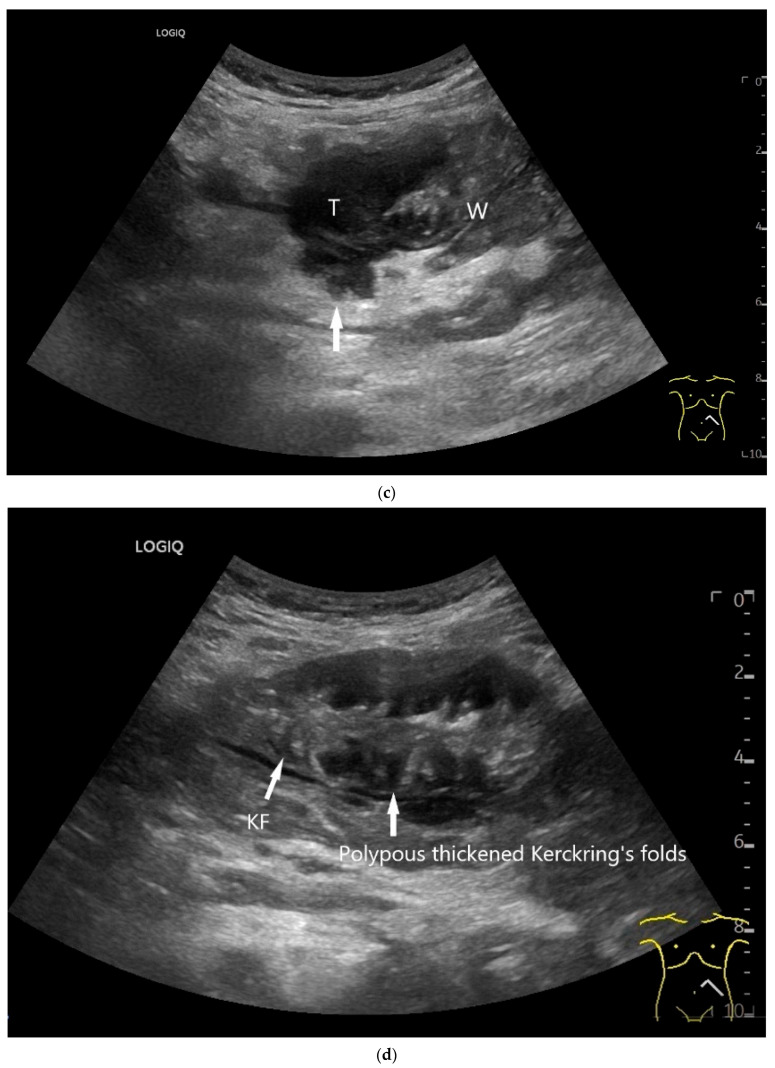 Figure 13