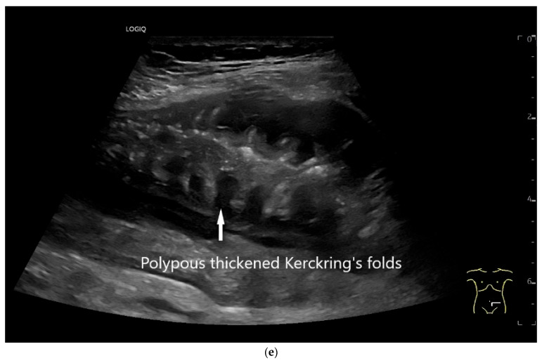 Figure 14
