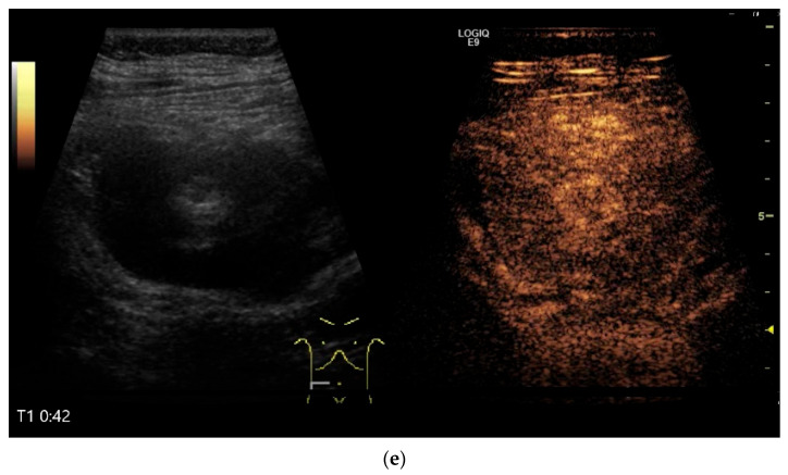 Figure 17
