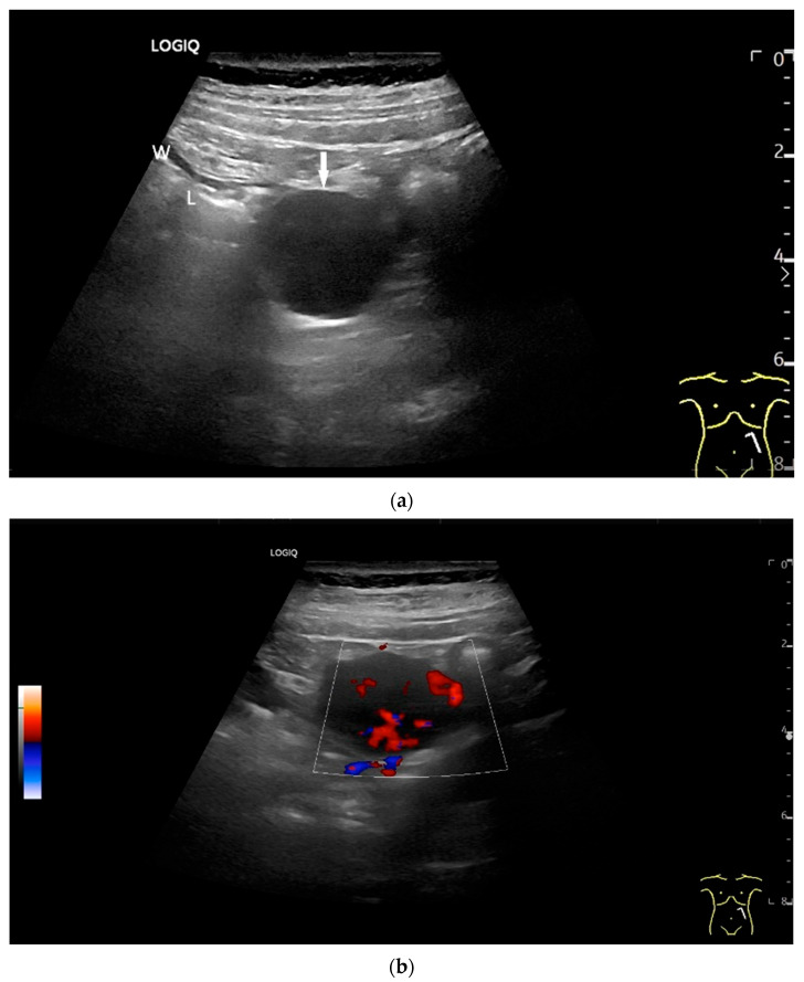 Figure 18