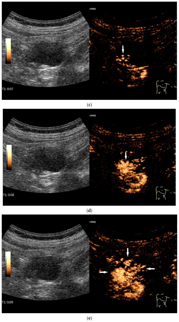 Figure 19