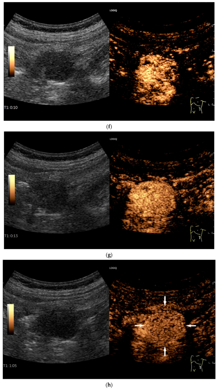 Figure 20