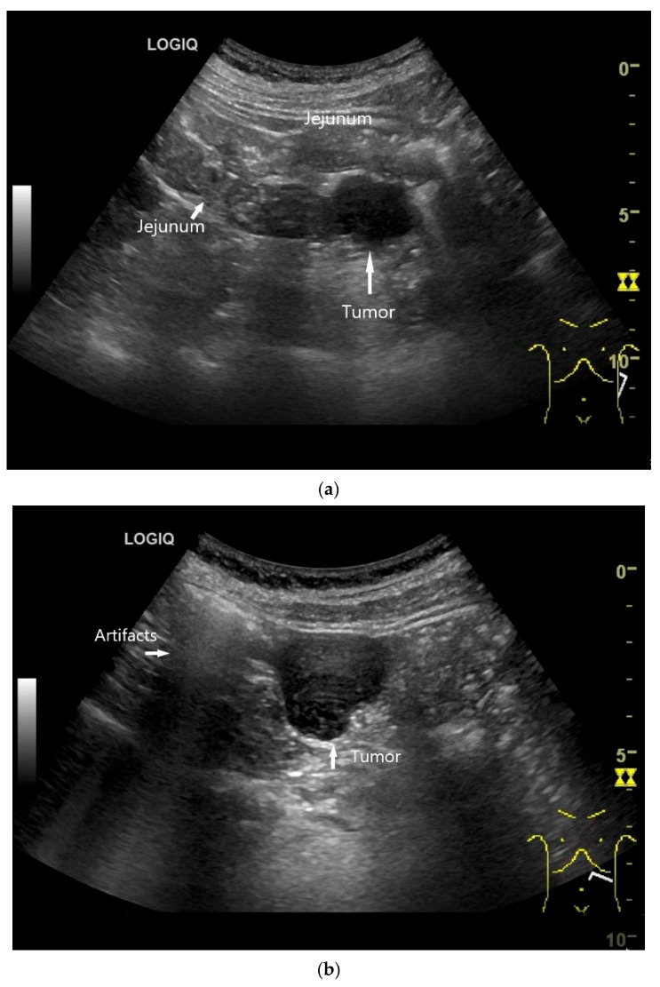 Figure 21