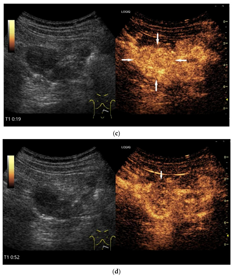 Figure 22
