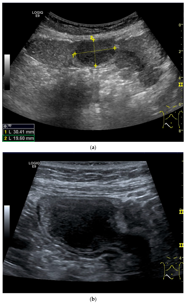 Figure 23