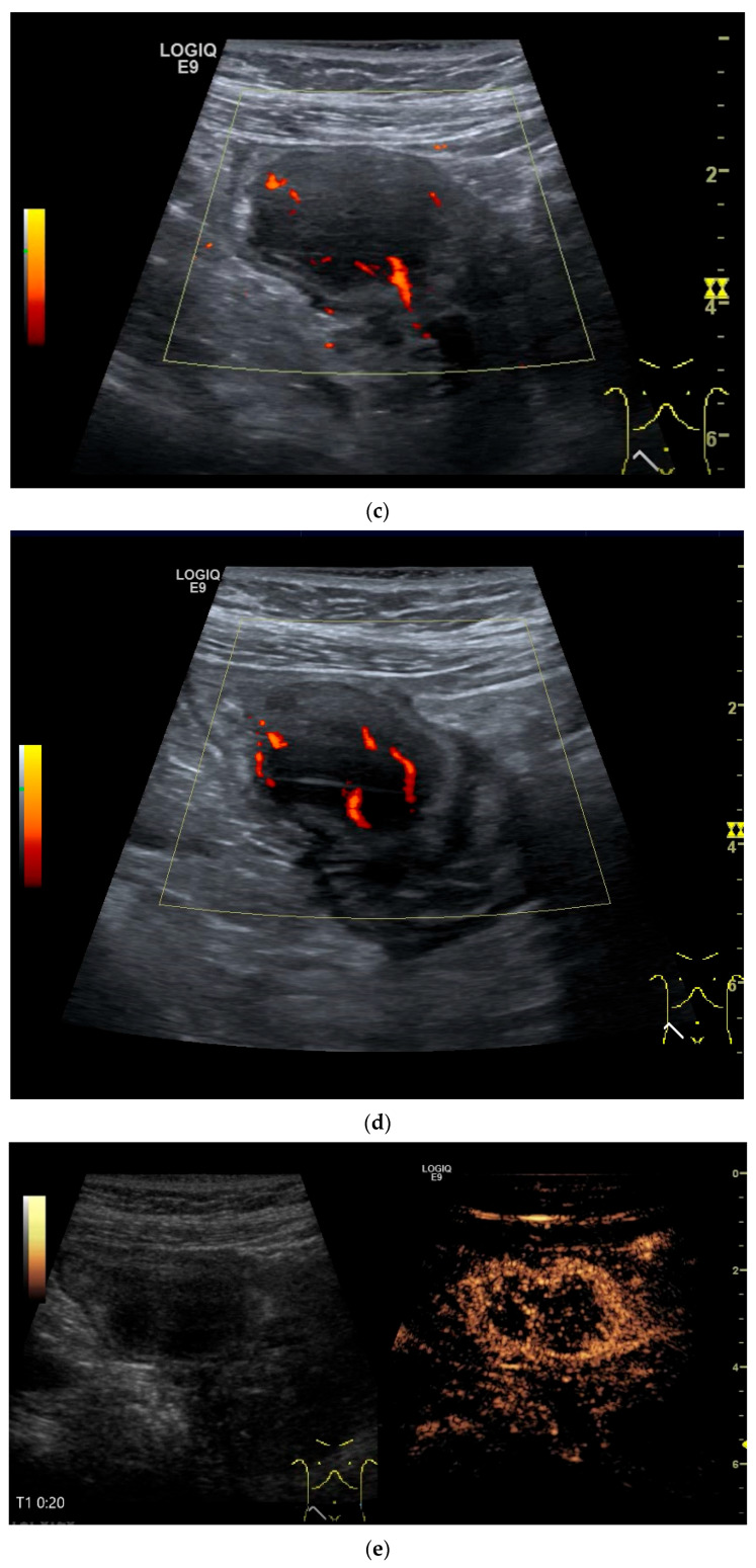Figure 24