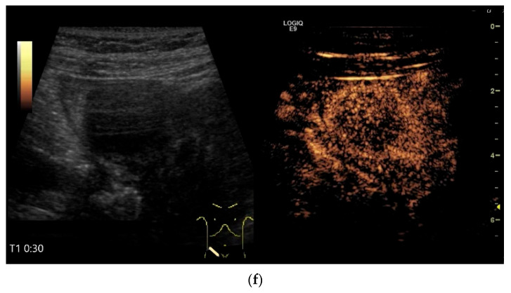 Figure 25