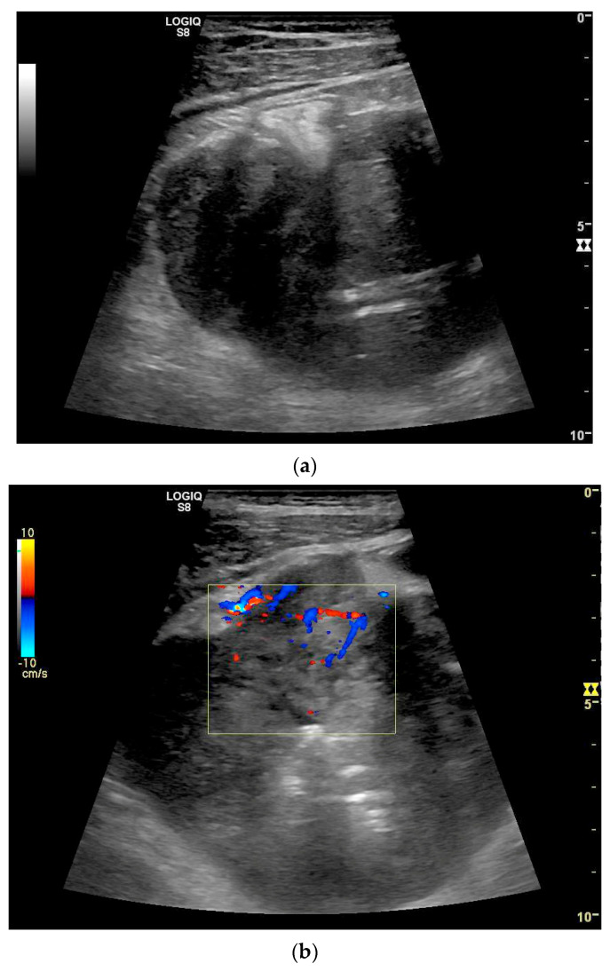 Figure 26