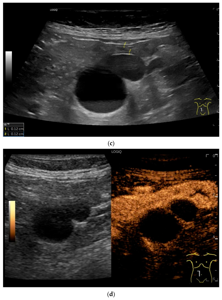Figure 28