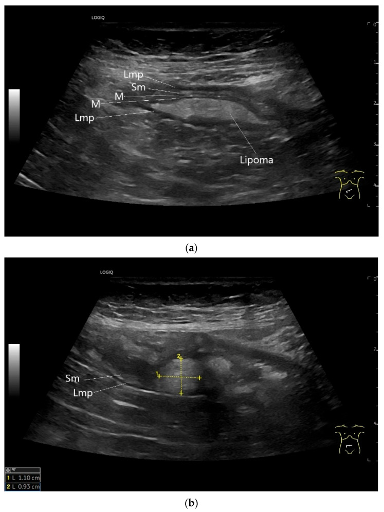 Figure 29