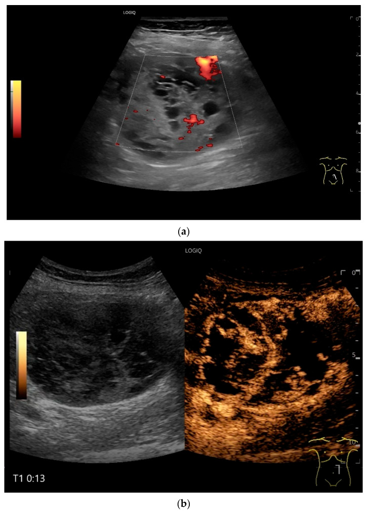 Figure 30