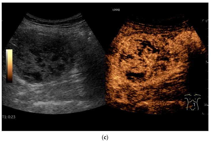 Figure 31