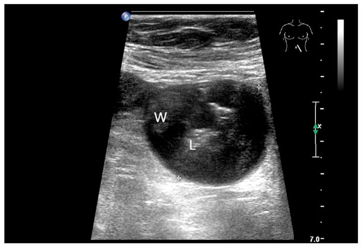 Figure 32