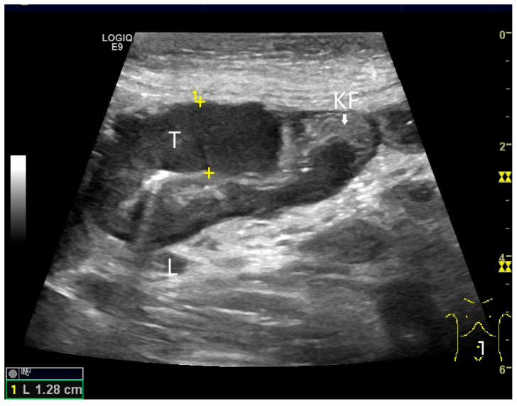 Figure 33