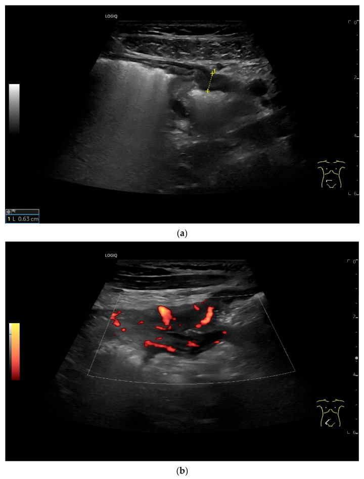 Figure 34