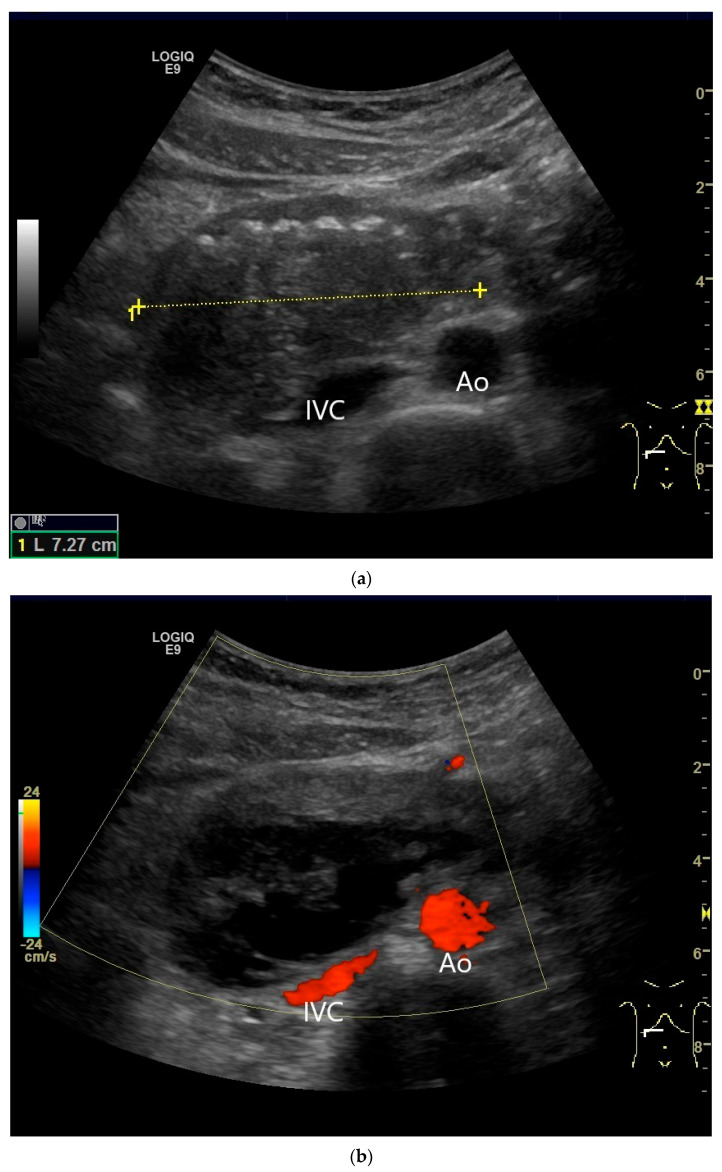 Figure 35