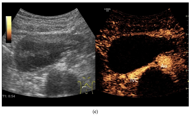 Figure 36