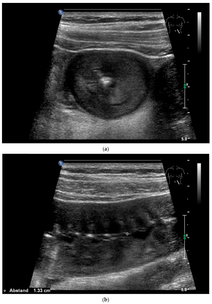 Figure 37