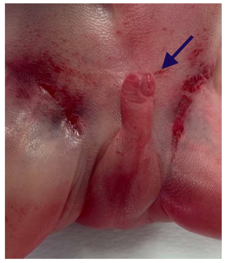 Figure 6