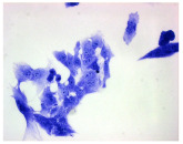Figure 17