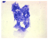 Figure 18