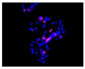 Figure 22