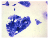 Figure 31