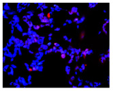 Figure 33