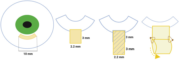 Fig 3