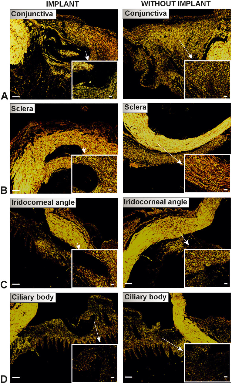 Fig 10