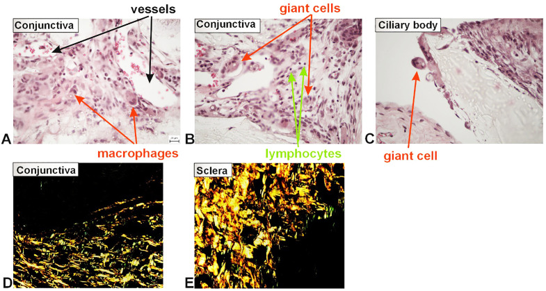 Fig 11