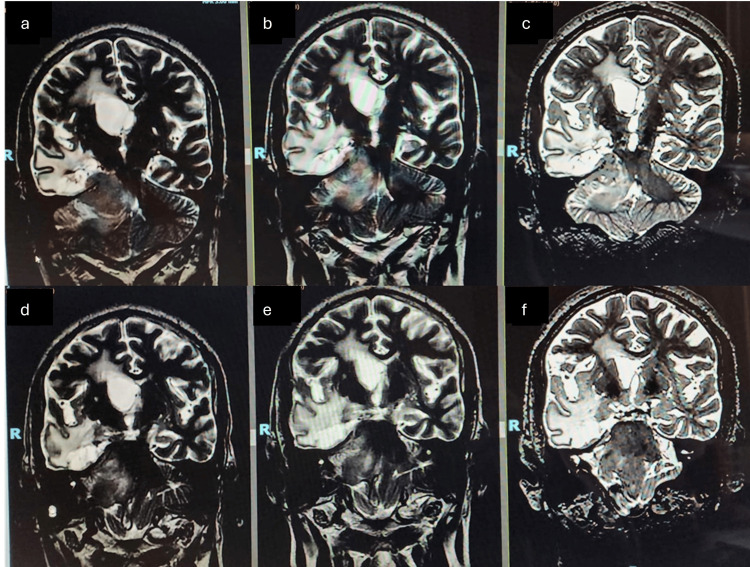 Figure 10