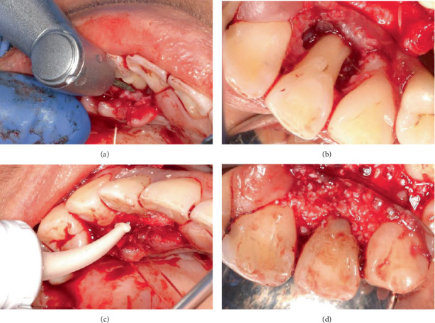 Figure 6