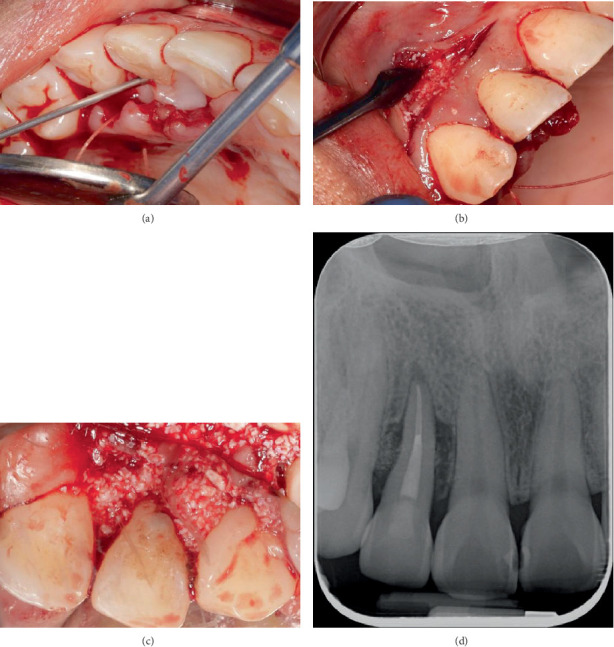 Figure 7