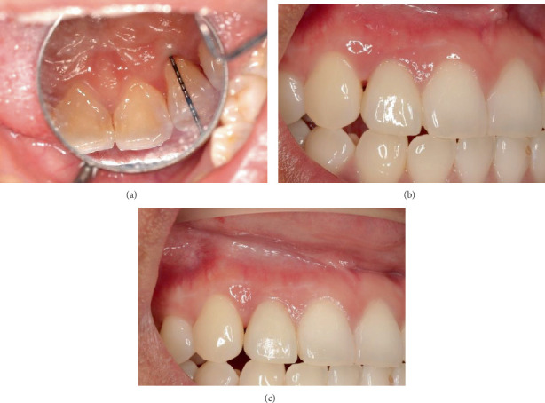 Figure 9