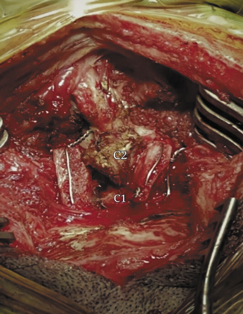 Fig. 2