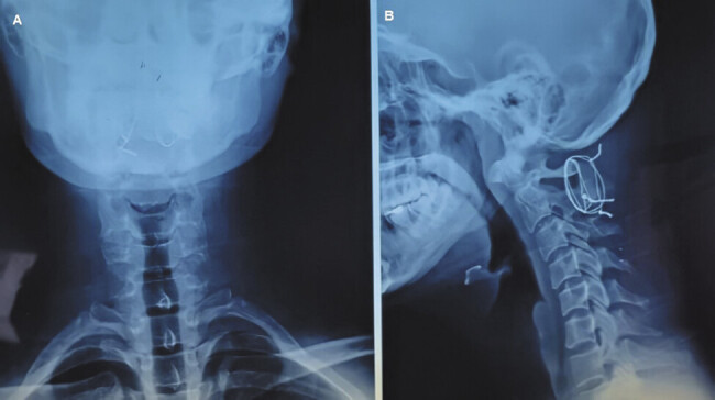 Fig. 3