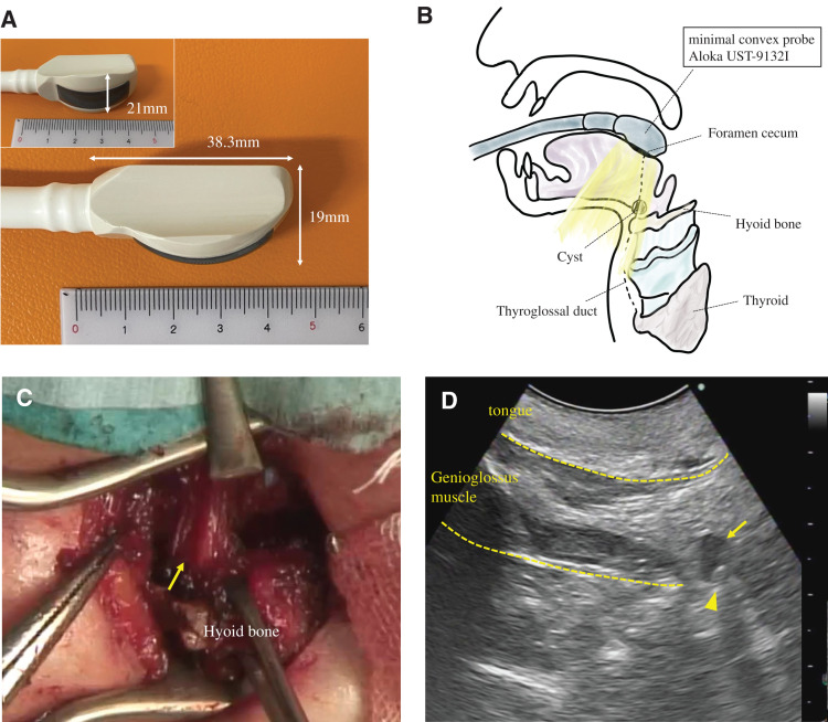 Fig. 2