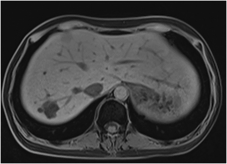 Fig. 10