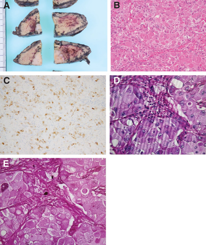 Fig. 11