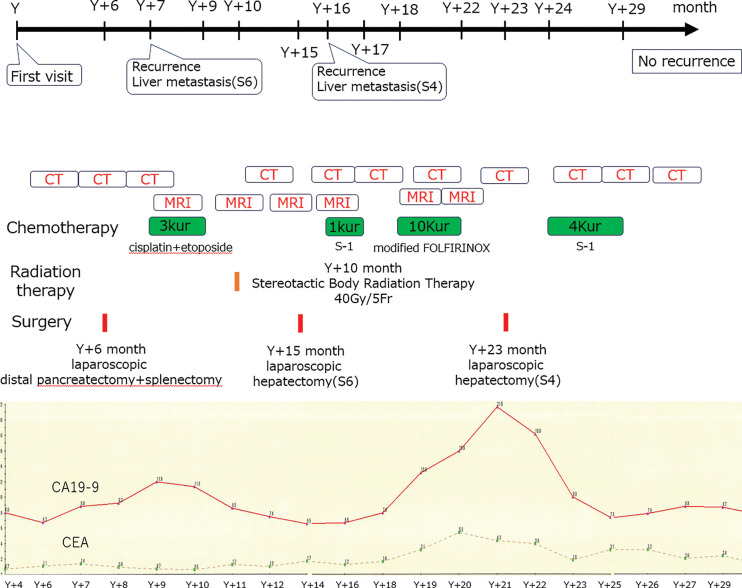 Fig. 12