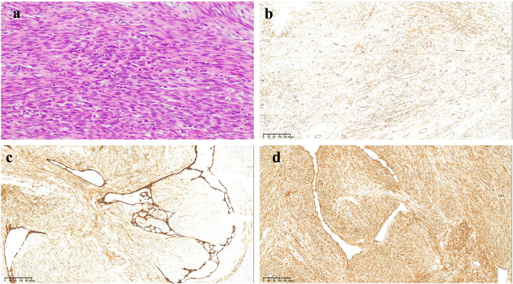 Figure 2