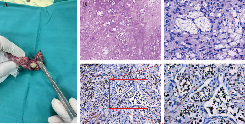 Figure 4