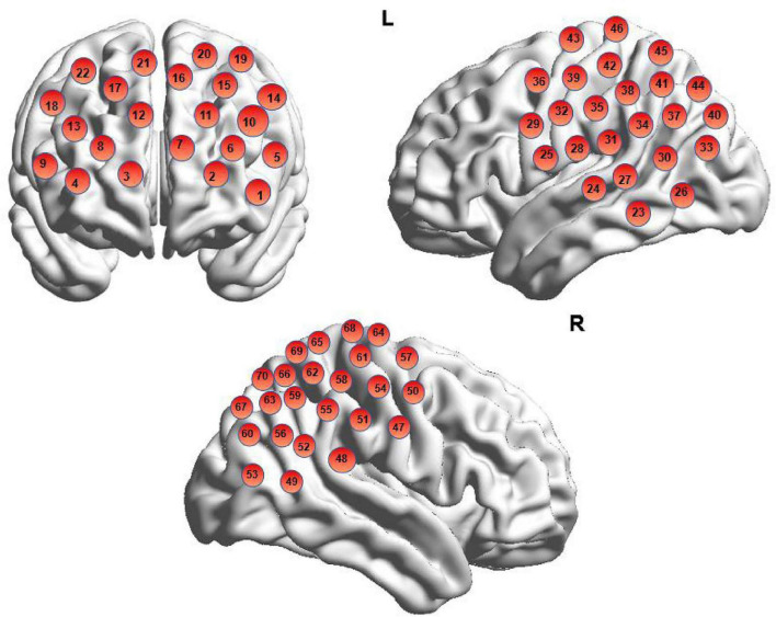 FIGURE 3