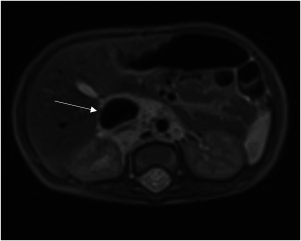 Figure 1