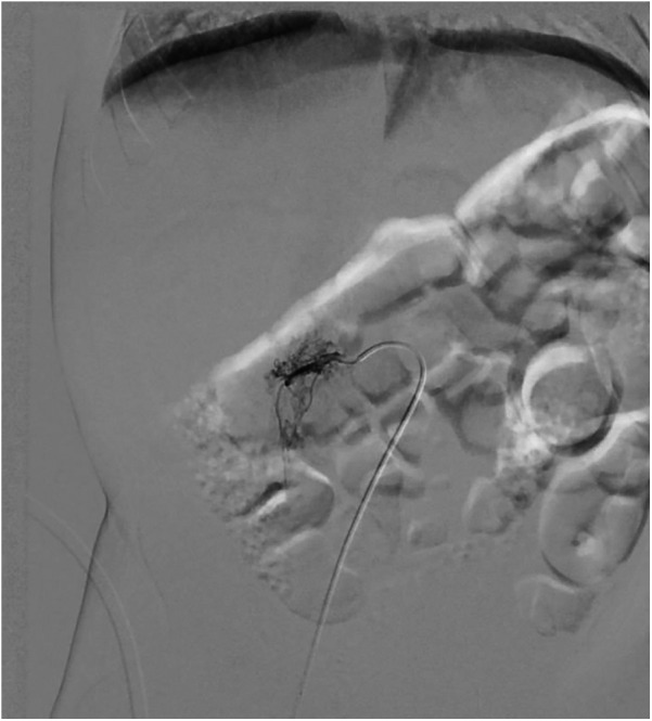 Figure 3